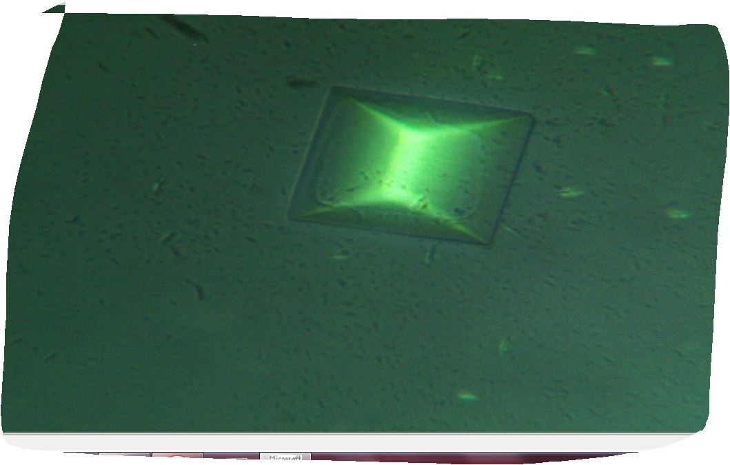 chi � questa vorticella con guscio?